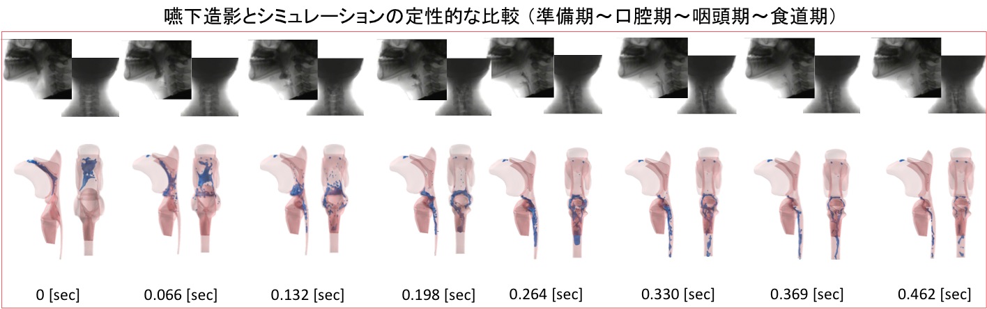 Qualitative comparison of swallowing imaging vs. simulation